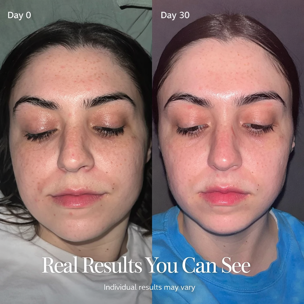 Crystalyne LUMA. 4-in-1 Facial Lifting Device