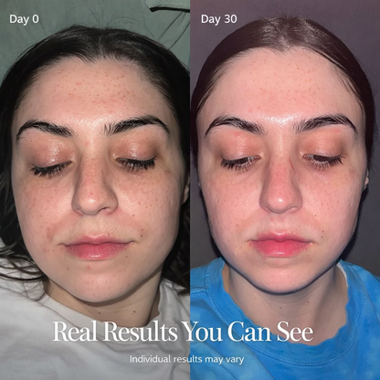 Crystalyne LUMA. 4-in-1 Facial Lifting Device